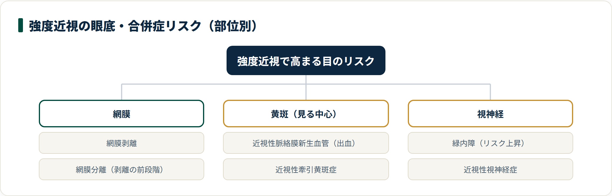 強度近視の眼底・合併症リスクを部位別に分類したツリー図。網膜は網膜剥離・網膜分離、黄斑は近視性脈絡膜新生血管・牽引黄斑症、視神経は緑内障・近視性視神経症のリスクが高まる。